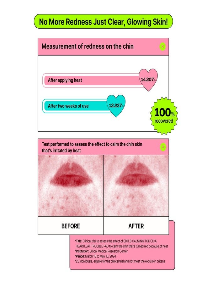 EDIT.B Calming Tok Cica Heartleaf Trouble Pads, Cooling & Hydrating Facial Toner Pads for Sensitive Skin, Mild Exfoliating & Soothing, Easy-Split for Multi-Use, Daily Korean Skin Care (70 Sheets - Image 5