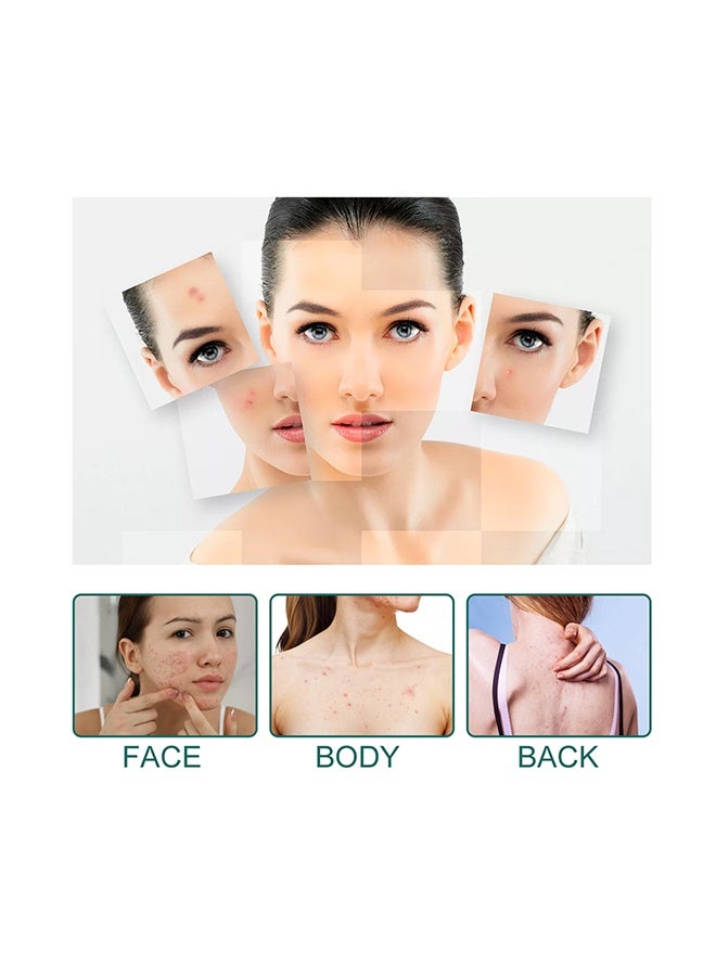 EELHOE Colorful Acne Patch Lighten Blemishes Pimple Marks Repair Clean Closed Cuts Cover Acne Pimple Repair Patch - Image 5