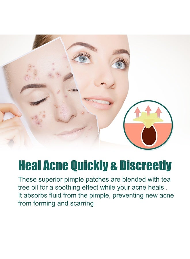 EELHOE Colorful Acne Patch Lighten Blemishes Pimple Marks Repair Clean Closed Cuts Cover Acne Pimple Repair Patch - Image 3