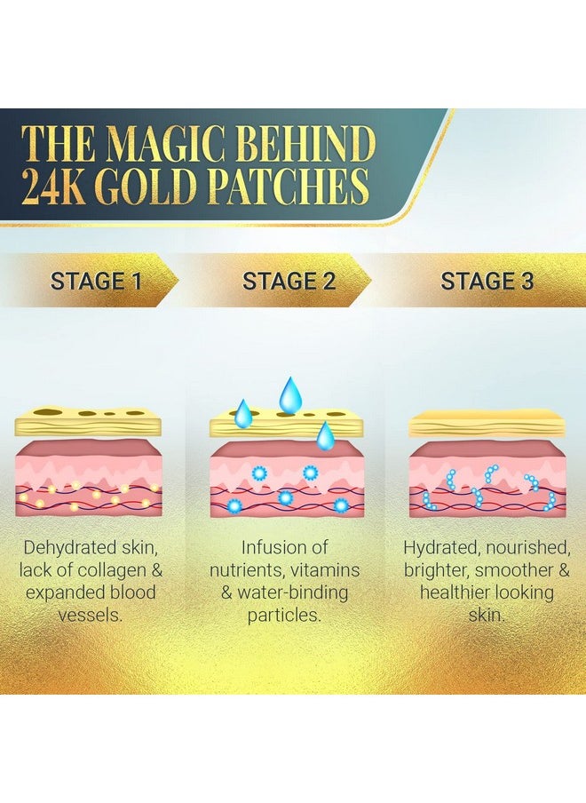 Matykos - Forehead Wrinkle Patches For Face Collagen Hyaluronic Acid And Vitamin A Skin Pads Forehead Line Remover Wrinkle Eye Patch Set 20 Golden Sachets - Image 1