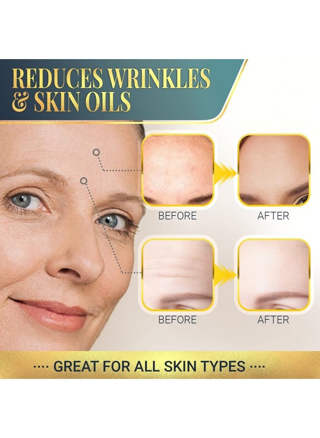Matykos - Forehead Wrinkle Patches For Face Collagen Hyaluronic Acid And Vitamin A Skin Pads Forehead Line Remover Wrinkle Eye Patch Set 20 Golden Sachets - Image 1