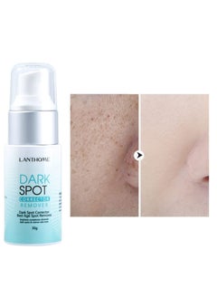30g of Professional Dark Spots Corrector and Remover For Both Men And Women