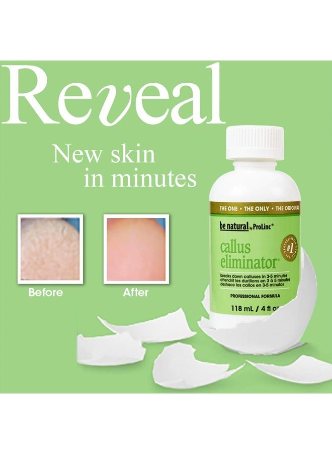 ProLinc مزيل مسامير القدم سريع المفعول، 4 أونصة سائلة (عبوة من 1) - Image 2