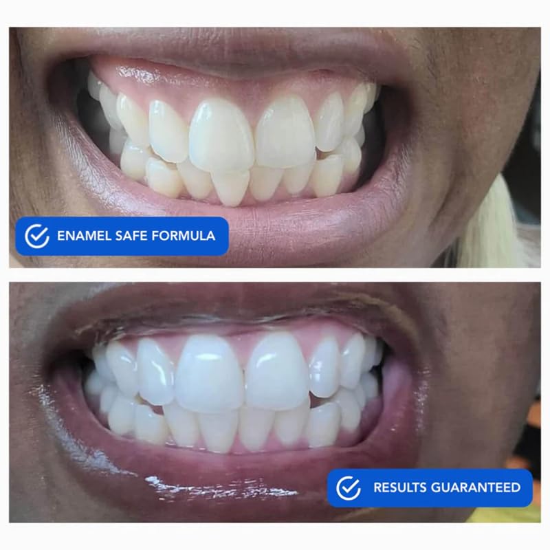 SNOW Diamond Dissolving Teeth Whitening Strips - Gentle & Enamel Safe White Strips for Teeth Whitening, at-Home Dental Hygiene & Tooth Care with Hydroxyapatite - 42 Ct - Image 5