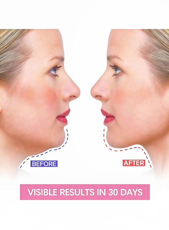 بيتشجوي مخفض الذقن المزدوج ، حزام تخسيس الوجه ، قناع على شكل حرف V حزام شد الوجه للنساء والرجال ، قناع الوجه المضاد للتجاعيد ، ضمادة الرفع لبشرة الوجه المترهلة قناع قابل لإعادة الاستخدام تنحيف الوجه - Image 2