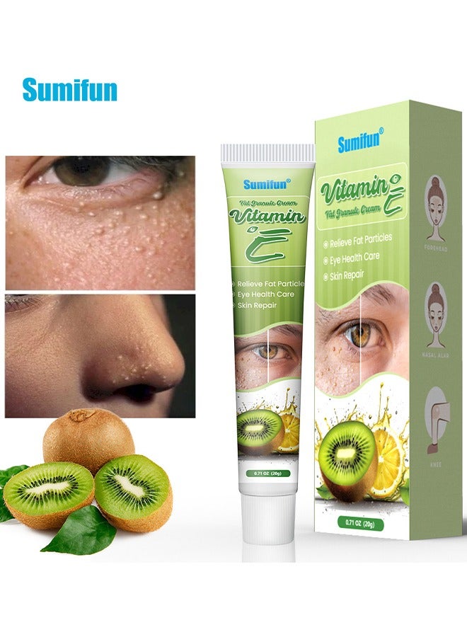 سوميفون علاج إزالة الميليا الأساسي، علاج بقع الميليا يساعد على ذوبان وتقليل الميليا والرؤوس البيضاء وتضخم الغدد الدهنية 20 جرام - Image 1