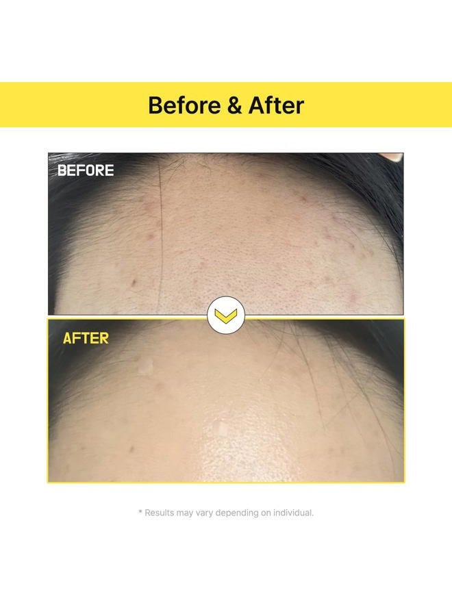 TIA'M كريم ألفا-5 ميلا للعناية، 1.69 أونصة سائلة، كريم تعزيز الإشراق بنسبة 5% ألفا أربوتين مع الجلوتاثيون والنياسيناميد، العناية بالبشرة الكورية - Image 2