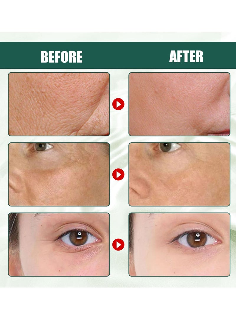 EELHOE - Osee Advanced Deep Anti Wrinkle Serum, Hyaluronic Acid Serum for Face, Anti-Aging Brightening Face Serum, Anti-Dark Spots and Brightening Serum, Firming, Plumping, Repair, Moisturizing - Image 1