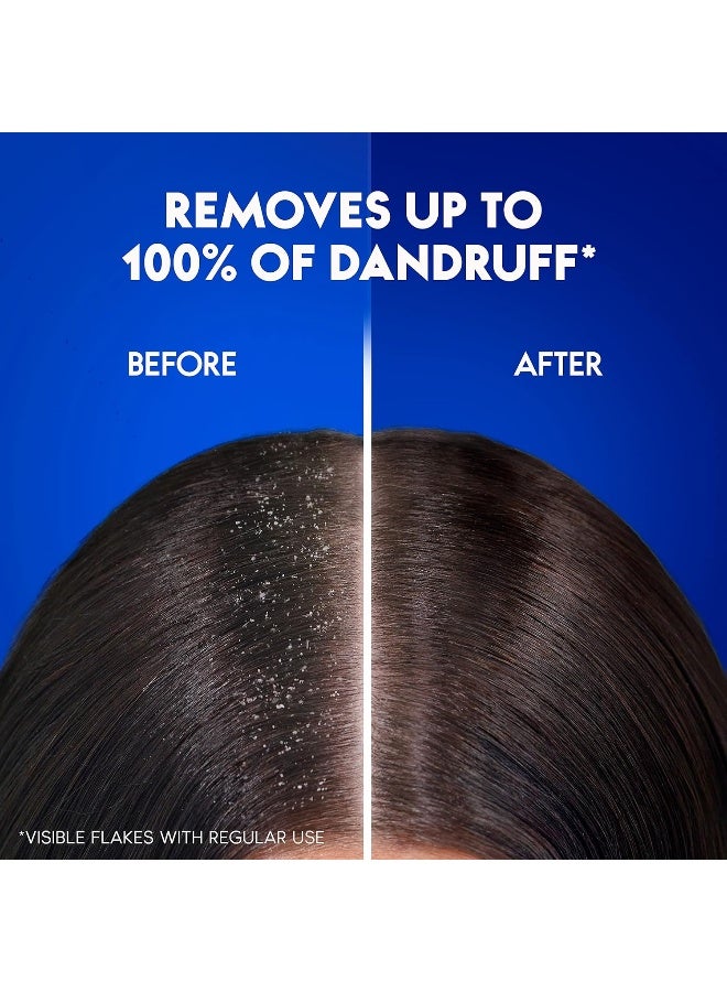 Head & Shoulders Extra Volume Anti-Dandruff Shampoo for Fine and Limp Hair, 400 ml - Image 2