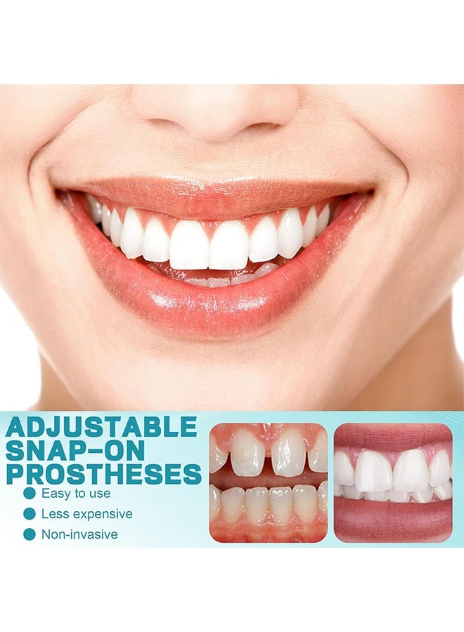 Veneers False Teeth  Adjustable Snap-On Braces  Comfortable Temporary Dental Restoration Kit - Image 3