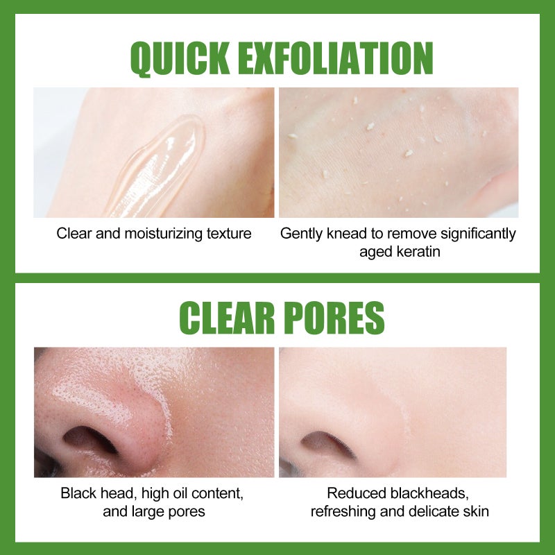 EELHOE 100g Aloe Vera Exfoliating Gel Soothing Moisturizing Skin Cleaning Pores Face Body Scrub Gel - Image 3