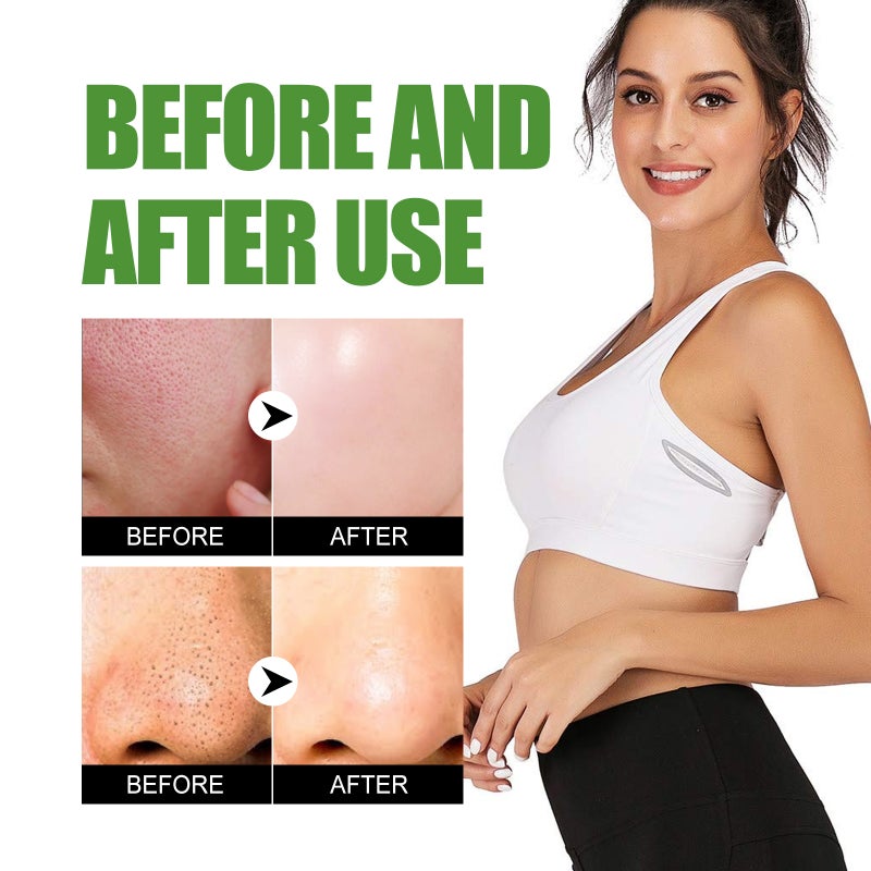 EELHOE 100g Aloe Vera Exfoliating Gel Soothing Moisturizing Skin Cleaning Pores Face Body Scrub Gel - Image 2