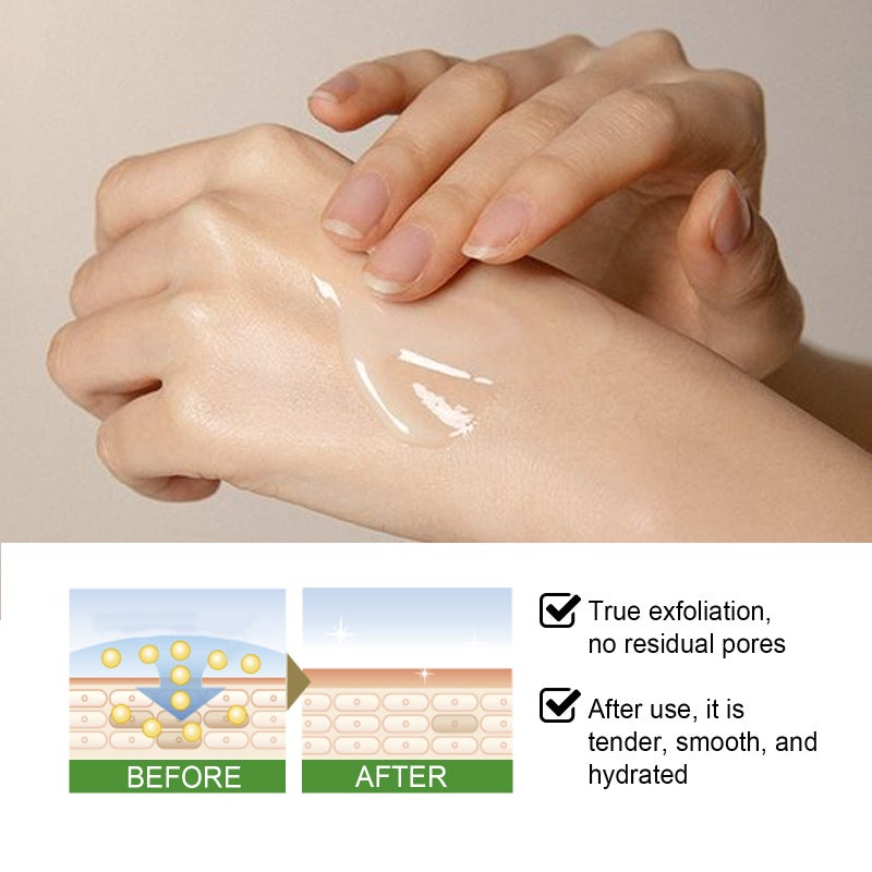 EELHOE 100g Aloe Vera Exfoliating Gel Soothing Moisturizing Skin Cleaning Pores Face Body Scrub Gel - Image 4