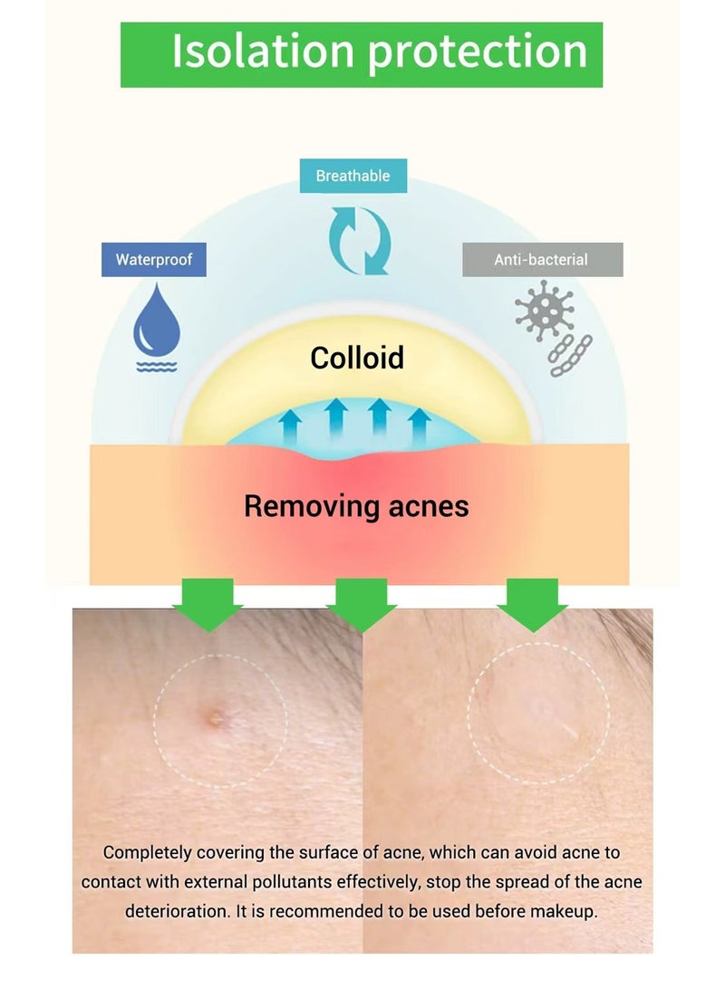 Breylee Acne Patches, Tea Tree Pimple Patches Acne Dots Acne Absorbing Cover Pimple Healing Sticker Acne Treatment Hydrocolloid Acne Patch (1 Pack, 22 Patches) - Image 2