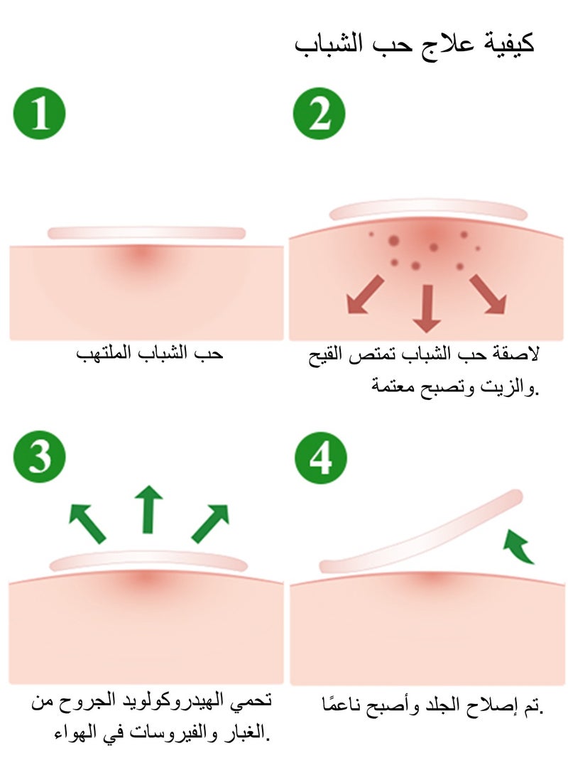 Breylee Acne Patches, Tea Tree Pimple Patches Acne Dots Acne Absorbing Cover Pimple Healing Sticker Acne Treatment Hydrocolloid Acne Patch (1 Pack, 22 Patches) - Image 5