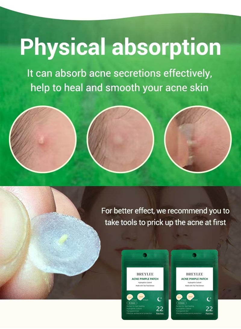 Breylee Acne Patches, Tea Tree Pimple Patches Acne Dots Acne Absorbing Cover Pimple Healing Sticker Acne Treatment Hydrocolloid Acne Patch (1 Pack, 22 Patches) - Image 3