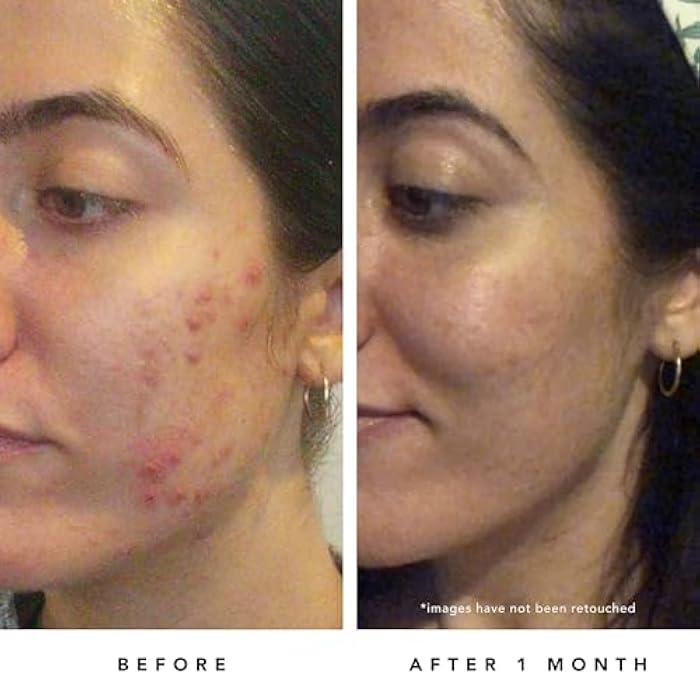 HERBIVORE Blue Tansy BHA & Enzyme Pore Refining Mask - Naturally Clarifies Acne, Blemishes & Redness, Vegan & Cruelty-Free, 60 mL / 2.02 oz - Image 5