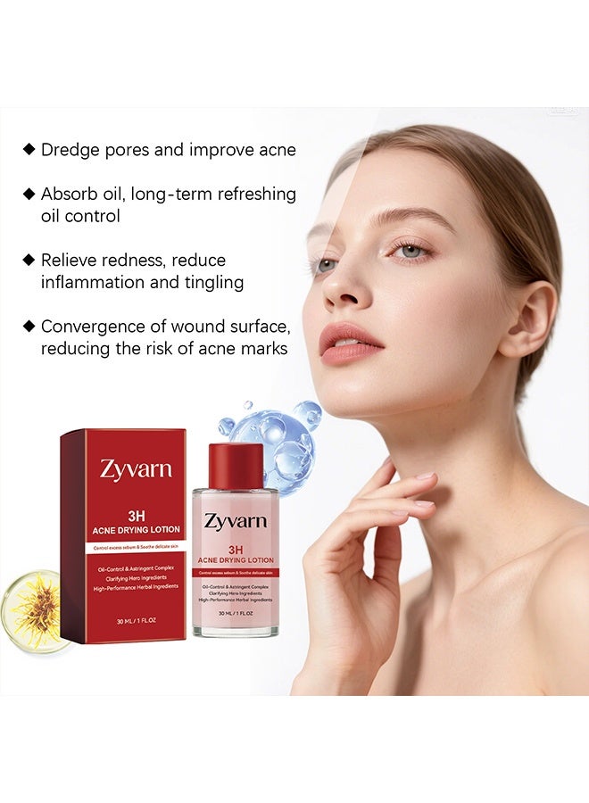 Zyvarn 3H Acne Drying Lotion, Drying Lotion Face Serum, Hydrating Facial Essence for Oil Control, Clean Pore & Smooth Skin, For All Skin Types,30ml 1 Fl Oz (1Pcs) - Image 3