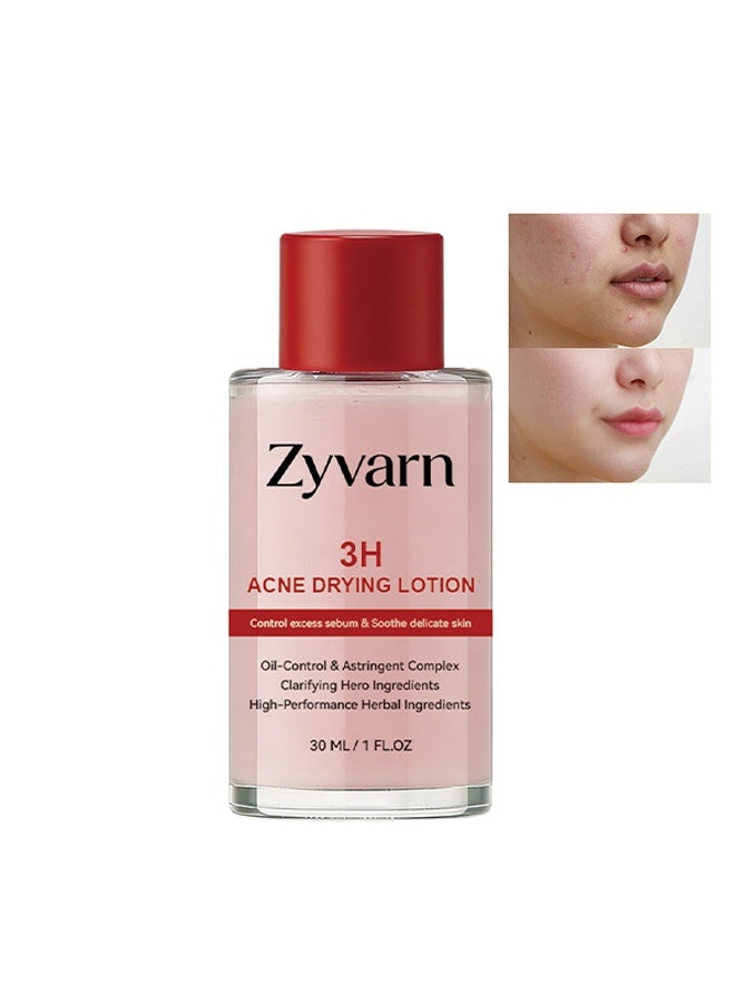 Zyvarn 3H Acne Drying Lotion, Drying Lotion Face Serum, Hydrating Facial Essence for Oil Control, Clean Pore & Smooth Skin, For All Skin Types,30ml 1 Fl Oz (1Pcs) - Image 1
