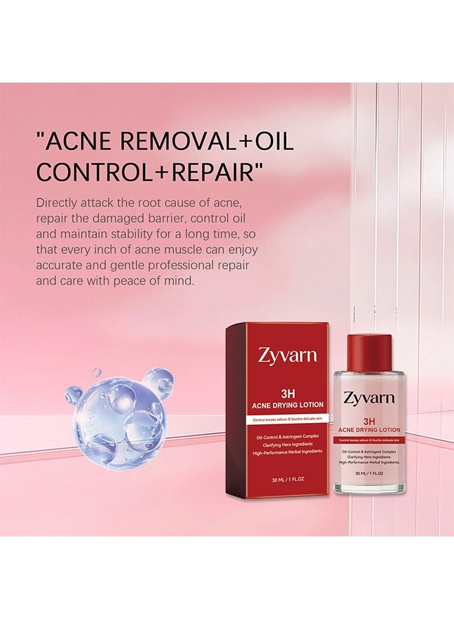 Zyvarn 3H Acne Drying Lotion, Drying Lotion Face Serum, Hydrating Facial Essence for Oil Control, Clean Pore & Smooth Skin, For All Skin Types,30ml 1 Fl Oz (1Pcs) - Image 2