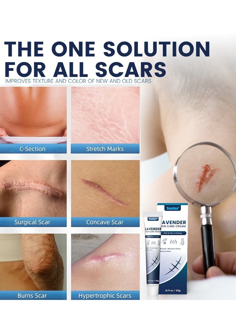 سوميفون كريم إصلاح الندبات، كريم إصلاح، جل إصلاح تضخم الجلد بدون ندبات، جل الندبات، علاج ندبات حب الشباب، حرق الندبات، إصلاح الدهون، الجلد التالف، إزالة علامات حب الشباب، كريم إصلاح الندبات. - Image 2