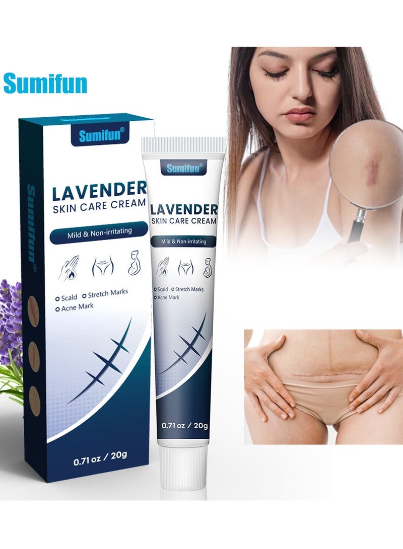 سوميفون كريم إصلاح الندبات، كريم إصلاح، جل إصلاح تضخم الجلد بدون ندبات، جل الندبات، علاج ندبات حب الشباب، حرق الندبات، إصلاح الدهون، الجلد التالف، إزالة علامات حب الشباب، كريم إصلاح الندبات. - Image 1