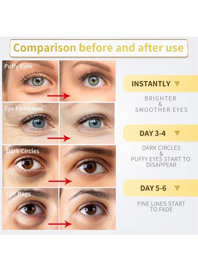 NAZANO Under Eye Patches - 30 Pairs - 24K Gold Eye Mask- Puffy Eyes & Dark Circles Treatments,Reduce Under Eye Bags and Smooth Wrinkles,Eye Skin Care Pads With Collagen - Image 2