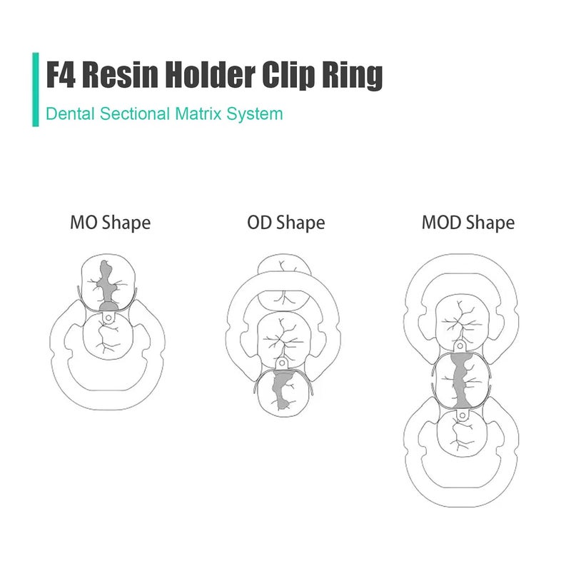 Dental Sectional Matrix System 1 Set With Contoured Metal Matrices Bands And Resin Rings - Image 5