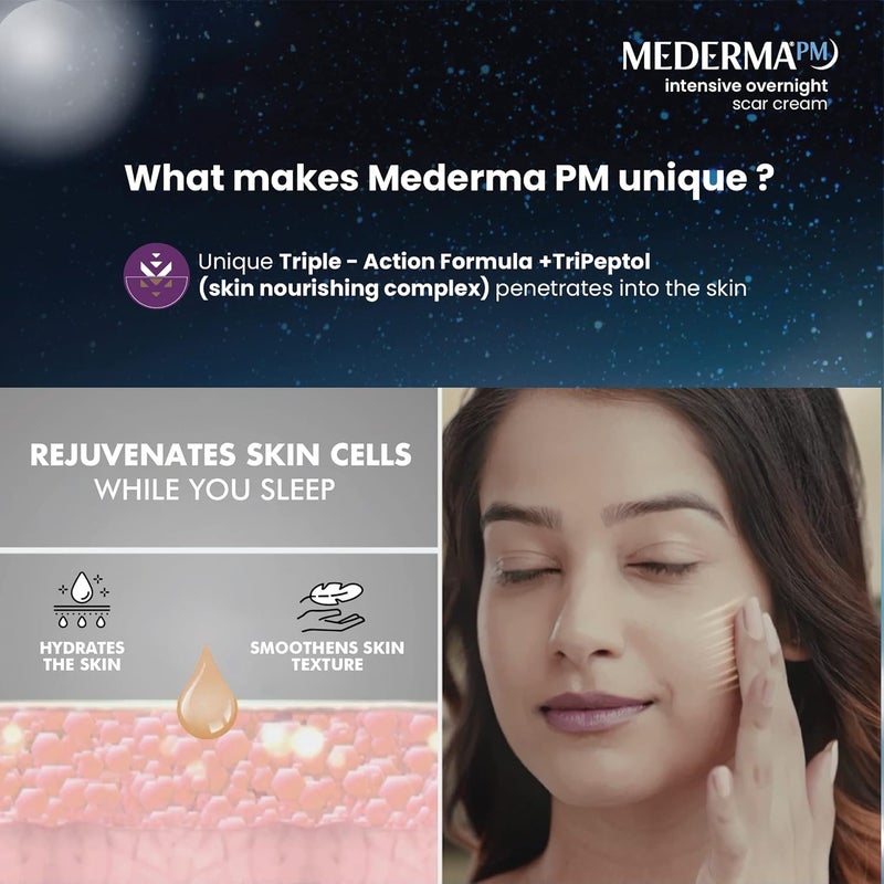 Mederma PM Old New Acne Scar Removal Cream 30g - Image 3