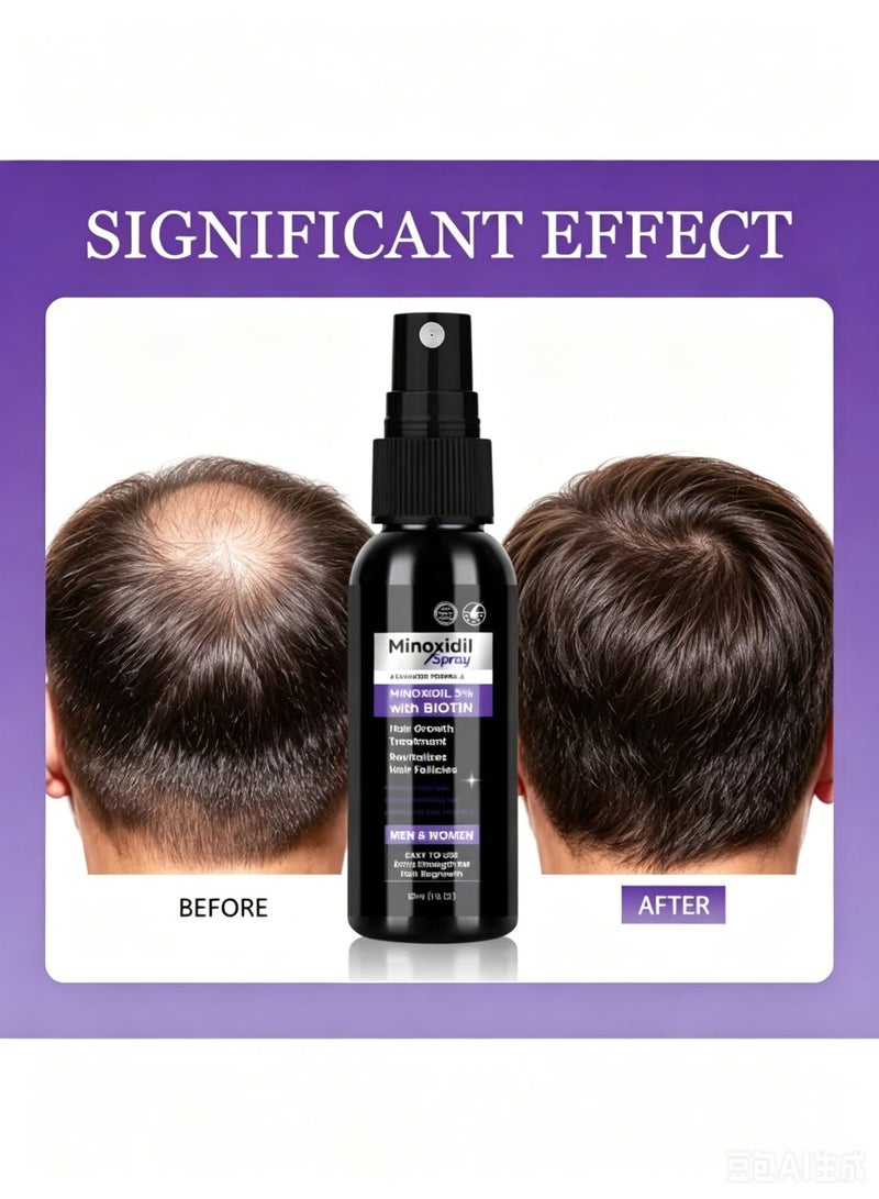KKV 💨 [5% Minoxidil + Biotin · Dual-Action Hair Density Spray] Advanced Formula Hair Growth Treatment | Activates Follicles × Strengthens Hair Roots | Deeply Nourishes & Repairs Sparse, Damaged Hair | Unisex · 30ml Convenient Spray | Effortlessly Tackle Hair Loss Concerns! - Image 5