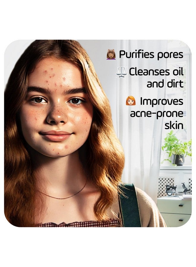 أسيبسيا صابون أسيبكسيا لعلاج حب الشباب وتنظيفه بعمق، مع صودا الخبز وحمض الساليسيليك بنسبة 2%، 4 أونصة - Image 3