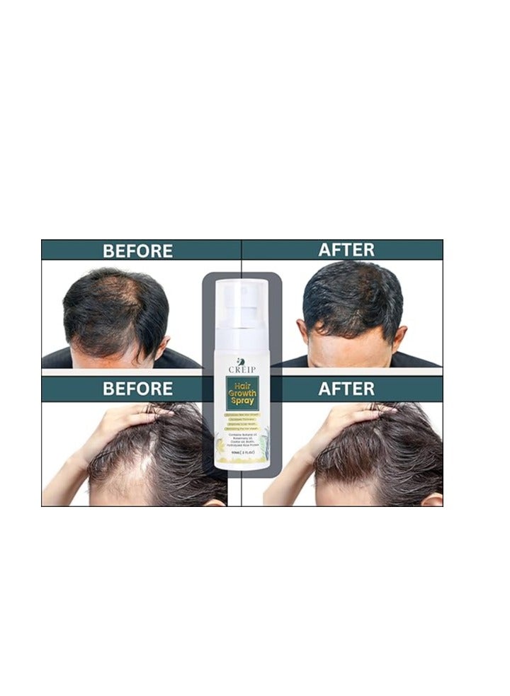 Creip Hair Growth Serum Spray Treatment: Natural formula with Batana Oil Castor Oil Rosemary Oil Rice Water and Biotin - Nurturing Scalp, Effective Hair Thickening for Women and Men 2 FL OZ - Image 5