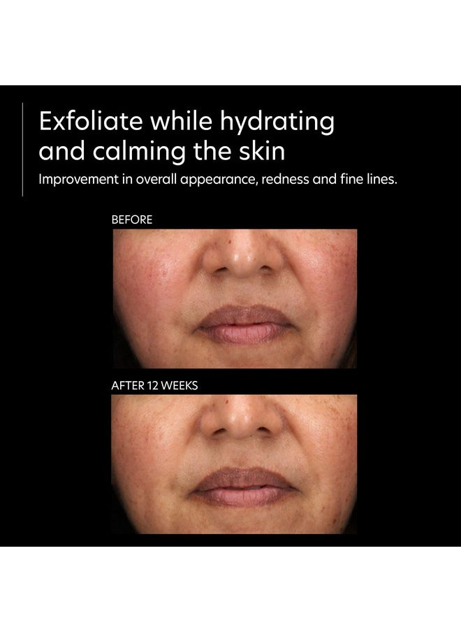 PCA SKIN Resurfacing Serum Gentle Exfoliating Facial Corrective With Lactic & Glycolic Acid For Bright Even Skin (1 Fl Oz)  - Image 5