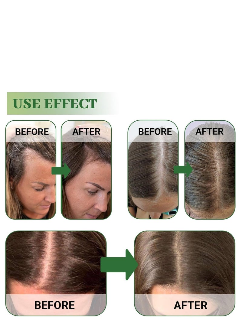 EELHOE Rosemary Hair Growth Set Infused With Biotin and Encourages Hair Growth, Hair Care Ki, Rosemary Oil Spray,Hair Serum Roller, Promotes Thicker, Fuller Hair, for Men and Women - Image 2