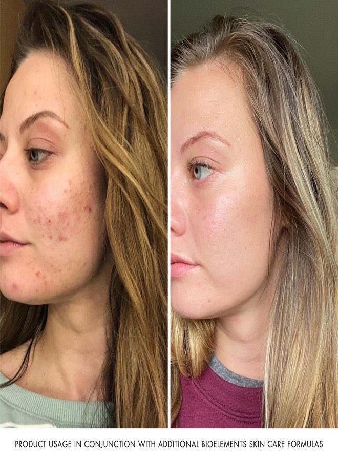 Bioelements RayDefense - 4 fl oz - Hydrating Broad-Spectrum SPF 30 Sunscreen & Moisturizer for All Skin Types - Vegan, Gluten Free - Never Tested on Animals - Image 5