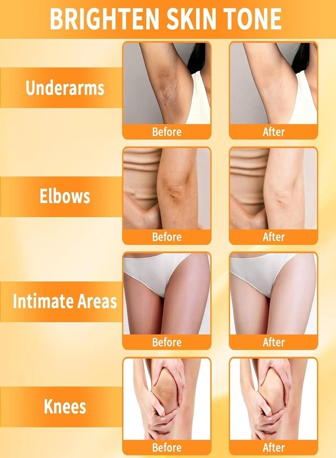 Dark Knees Remover Underarm Cream Body Moisturizer Lotion Dark Toe Knuckles Treatment Removal Remover Corrector for Armpit Elbow Inner Thigh Neck Private Part Intimate Legs Skin Cream, 50ML/1.8 Fl Oz - Image 4