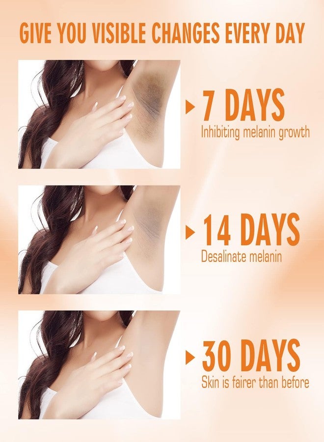 Dark Knees Remover Underarm Cream Body Moisturizer Lotion Dark Toe Knuckles Treatment Removal Remover Corrector for Armpit Elbow Inner Thigh Neck Private Part Intimate Legs Skin Cream, 50ML/1.8 Fl Oz - Image 3