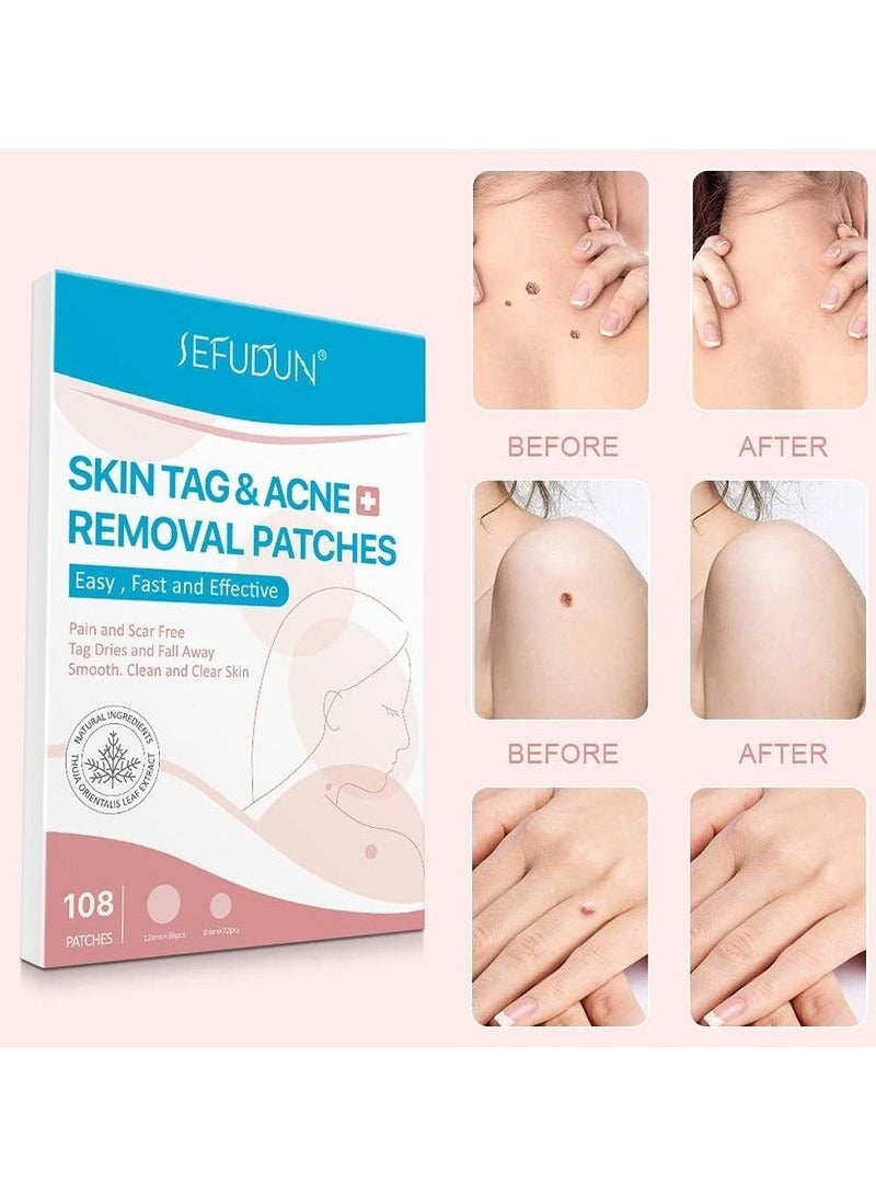 سيفودون إزالة حب الشباب التصحيح ، 108pcs تسمية الجلد إزالة حب الشباب إزالة حب الشباب امتصاص تغطية - عدوى غير مرئية غرواني مائي علاج العناية بالبشرة - Image 2