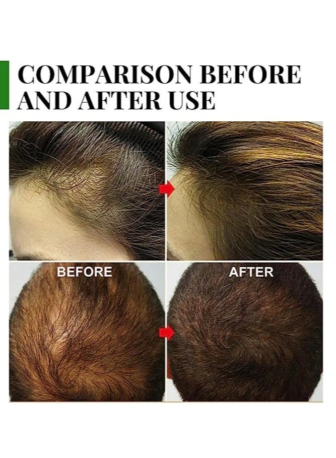 إيلهو زيت روزماري لنمو و علاج تساقط الشعر 30مل - Image 2