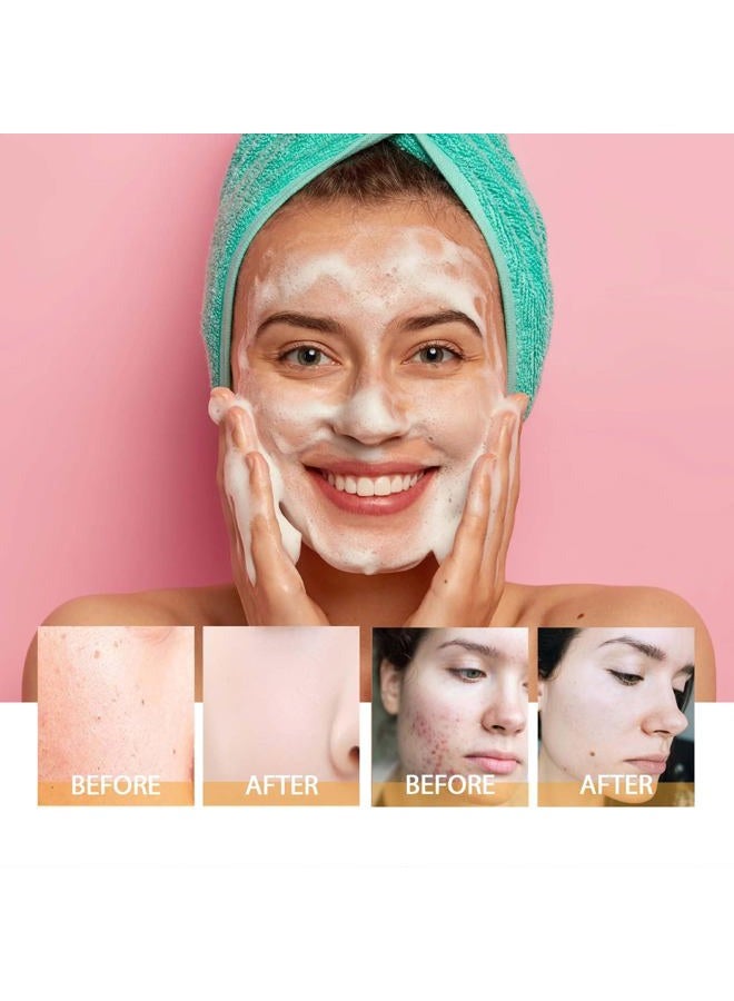 JISKG 2 Pcs Turmeric Facial Cleanser, Glow Wash Turmeric Face Wash With Brush, Deep Cleansing Exfoliating for Women All Skin. - Image 5
