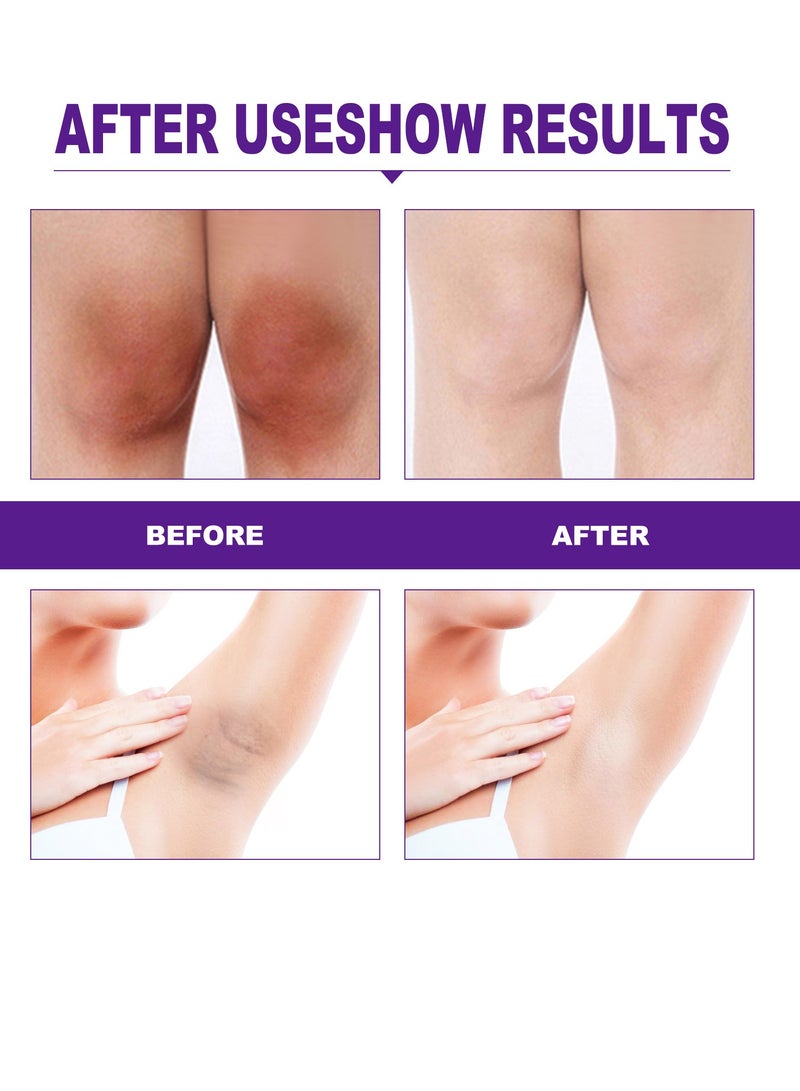 إيلهو Daily Care Moisturizing LipstickBlack Joint Removal - Image 3