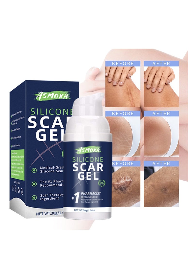 Scar Gel, Acne Treatment, Deep Acne Scar Removal, Burn Keloid Hyperplasia, Scar Removal Cream, Repair Damaged Skin, Acne Mark Removal, Scar Repair Cream - pzsku/ZBB5612414393A0065B7AZ/45/_/1734341637/b8c232cd-0112-4f42-a485-2ef62d977af3