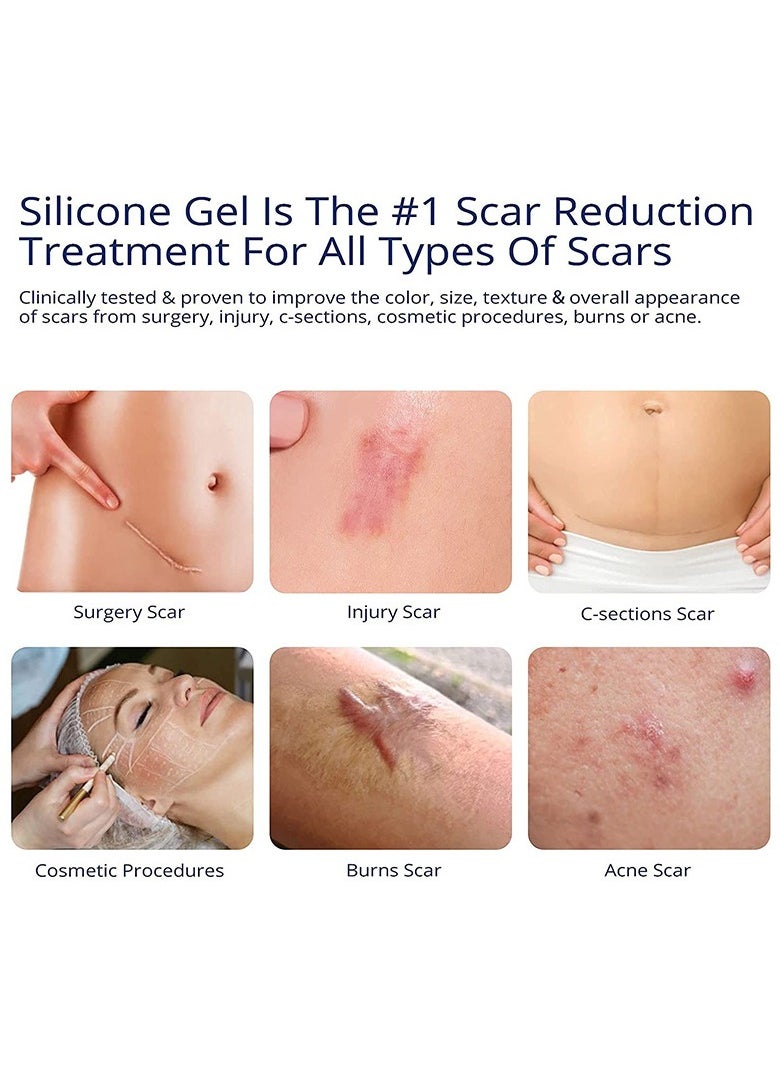 Scar Gel, Acne Treatment, Deep Acne Scar Removal, Burn Keloid Hyperplasia, Scar Removal Cream, Repair Damaged Skin, Acne Mark Removal, Scar Repair Cream - pzsku/ZBB5612414393A0065B7AZ/45/_/1734341729/09f9e3e0-426d-41c1-a3dd-f4b0ed4c495e