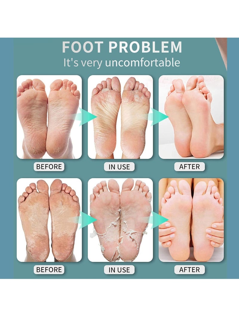 DubaiGallery 30ml Foot Herbal Shoe Deodorant Spray Foot Odor Shoe Odor Nemesis Odor Removal Artifact Foot Spray - Image 3