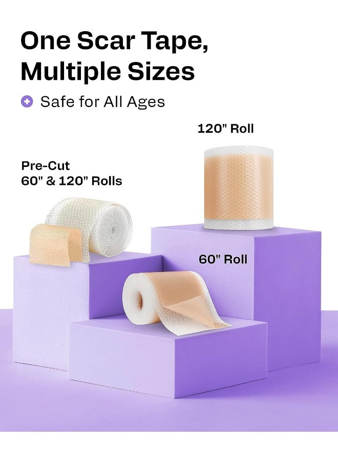 AWD Medical - AWD Medical Soft Silicone Tape for Scars Removal with Silicone Gel Sheeting (1.6inx 120in) - Image 1