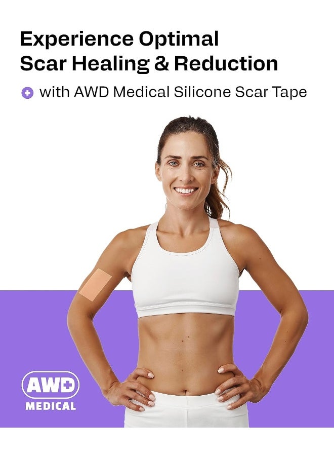 AWD Medical - AWD Medical Soft Silicone Tape for Scars Removal with Silicone Gel Sheeting (1.6inx 120in) - Image 1