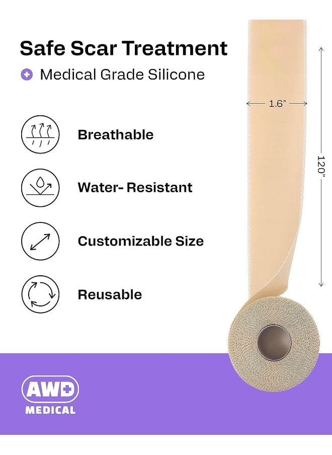 AWD Medical - AWD Medical Soft Silicone Tape for Scars Removal with Silicone Gel Sheeting (1.6inx 120in) - Image 1