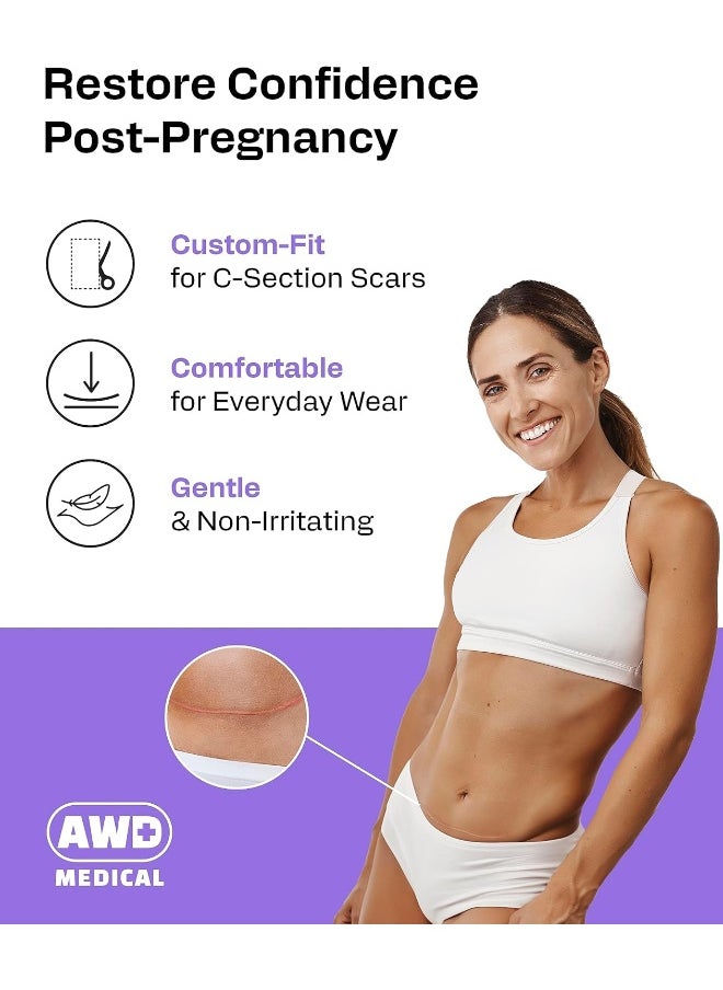 AWD Medical - AWD Medical Soft Silicone Tape for Scars Removal with Silicone Gel Sheeting (1.6inx 120in) - Image 1