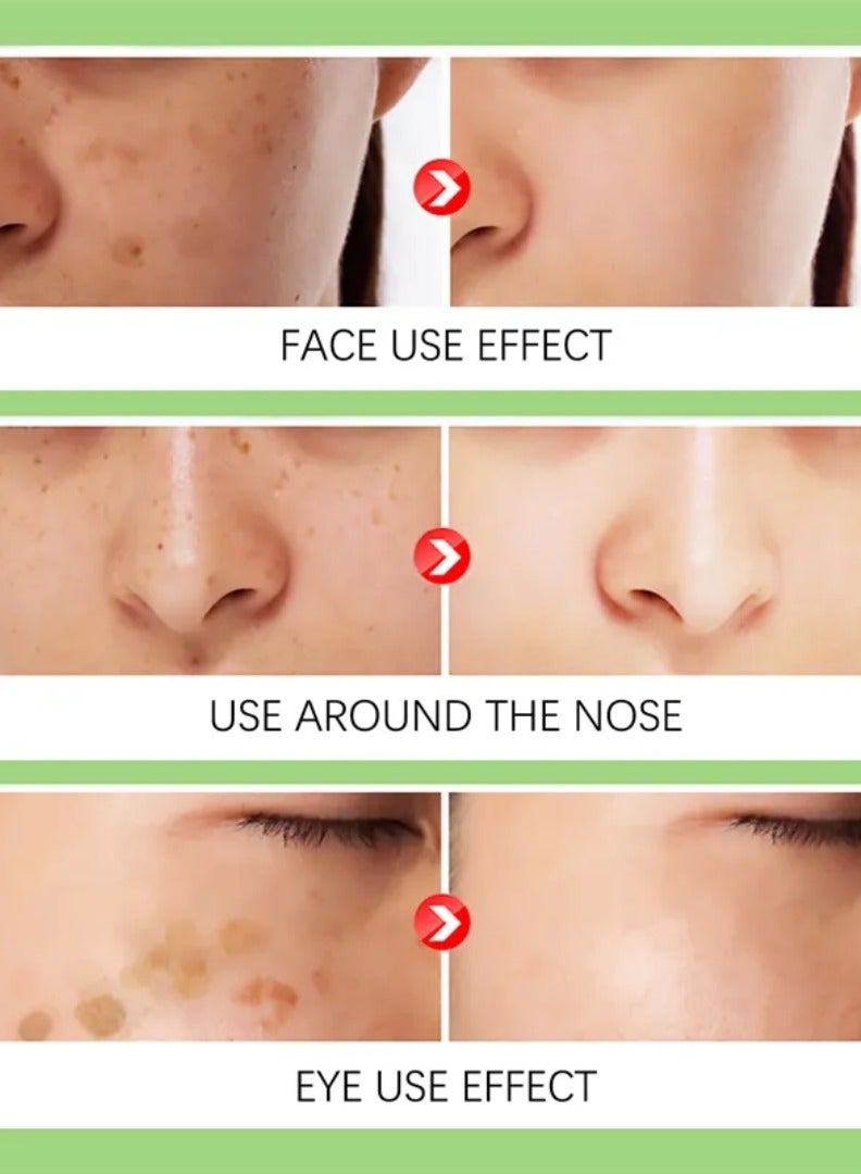 Jaysuing Color Control Green Cream Light Spots Breaks Down Melanin Removing Dark Spot Whitening and Freckle Removing Cream Moisturizing Cream Melasma Acne Skin Care Cream Dark Spot Corrector Cream 30g - Image 2