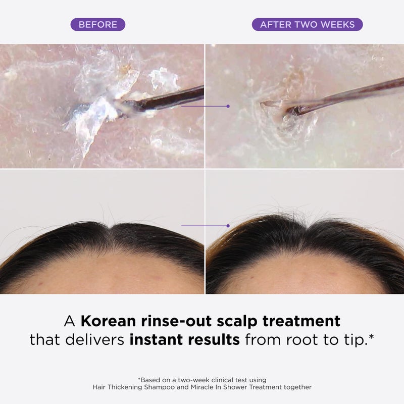Dr.Groot Dr. Groot Miracle in Shower Moisturizing Treatment for Hair Loss, Korean Hair Care Rinse, Rosemary Oil for Smooth, Healthier-Looking Hair in 5 Seconds, Scalp Revitalizing Solution, 250 ML - Image 2